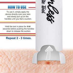 Planet Gates 1pc 1pc, Suction Tool, Poison Remover, Bug Bites And Bee/Wasp Stings, Natural Insect Bite Relief, Chemical Free, Indoor Insect Traps For Garden Indoor House Kitchen Plants Pest Control Supplies (White/Single)