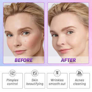 Planet Gates 1set / United States 7 Electrode Tubes Beauty Machine Ozone High Frequency Wand for Face Hair Eye Massage Face Care Skin Care Device for Women&Men
