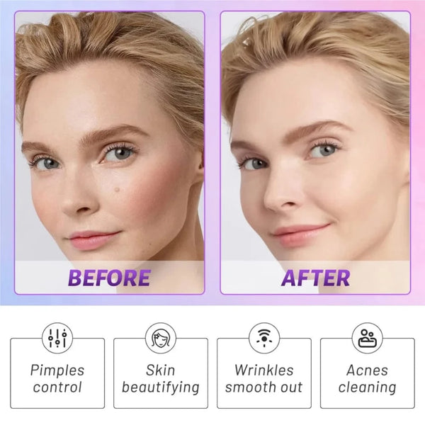 Planet Gates 1set / United States 7 Electrode Tubes Beauty Machine Ozone High Frequency Wand for Face Hair Eye Massage Face Care Skin Care Device for Women&Men