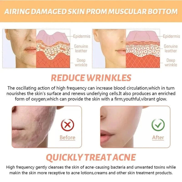 Planet Gates Facial Galvanic High Frequency Facial Therapy Wand For Hair Growth 4 In 1 Acne Removal Skin Care Glass Tube Facial Beauty Tools