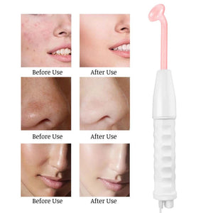Planet Gates Facial Machine For Skin Tightening Facial Machine High Frequency Electrode Facial Machine For Skin Body Care Wrinkle Remover