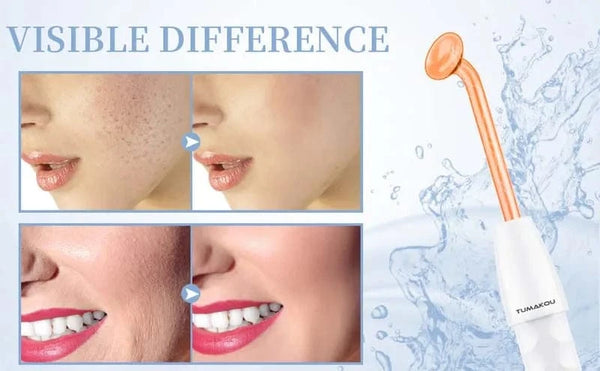 Planet Gates Facial Skin Care High Frequency Facial Wand Portable Hand-Held High Frequency Facial Machine with 4 Pcs Different Tubes