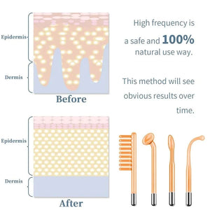 Planet Gates Facial Skin Care High Frequency Facial Wand Portable Hand-Held High Frequency Facial Machine with 4 Pcs Different Tubes