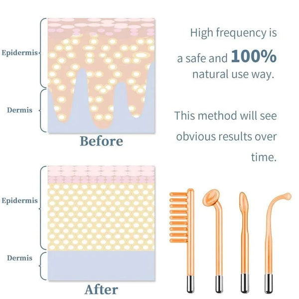 Planet Gates Facial Skin Care High Frequency Facial Wand Portable Hand-Held High Frequency Facial Machine with 4 Pcs Different Tubes