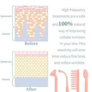 Planet Gates High Frequency Skin Therapy Wand Machine Portable Handheld for Acne Massage Skin Rejuvenation Tightening Wrinkle Reducing Tool