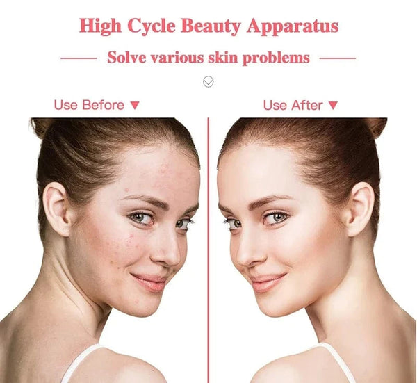 Planet Gates Portable High Frequency Facial Machine Wand Handheld Electric Face Skin Beauty Tools Acne Treatment Device