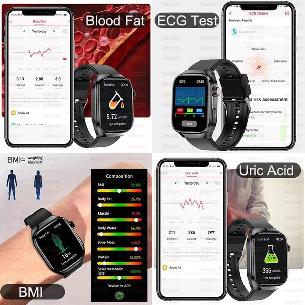 Planet Gates Silver / Medical grade For HUAWEI Xiaomi New Uric Acid Blood Fat Smartwatch ECG Blood Glucose Heart Rate Blood Pressure Health Monitoring Smart Watch