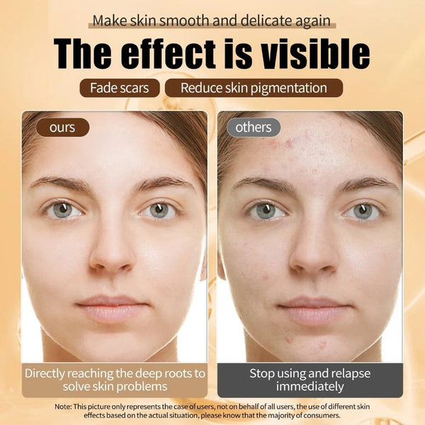 Planet Gates Snail mucin 96% authentic skin care facial moisturizing snail essence fades fine lines repair essence tightens the face