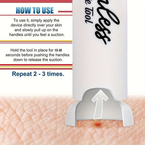 Planet Gates White 1pc, Mosquito Anti-itch Extraction Needle Device, Mosquito Insect Outdoor Portable Insect Bite Repair Artifact, Vacuum Canning Device