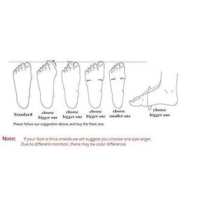 Planet Gates 1 / 7 New 2018 spring fashion men casual shoes Suede leather platform shoes men sneakers vulcanized shoes size 39-44