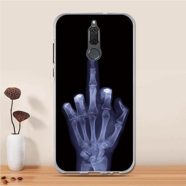 Planet Gates 19 3D Case For Huawei Mate 10 Lite Case Cover Silicon for Huawei Nova 2i Case Cover Huawei Mate 10 Lite 10lite/ Nova 2i / Honor 9i