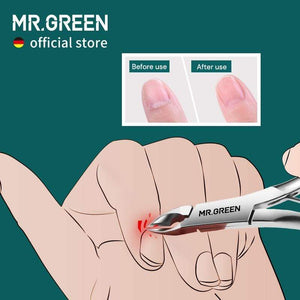 Planet Gates Cuticle Nippers Nail Manicure Cuticle Scissors Clippers Trimmer Dead Skin Remover Pedicure Stainless Steel Cutters Tool