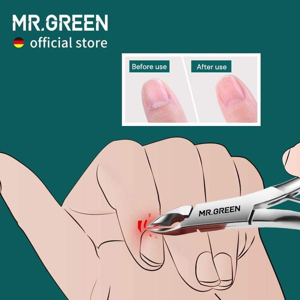 Planet Gates Cuticle Nippers Nail Manicure Cuticle Scissors Clippers Trimmer Dead Skin Remover Pedicure Stainless Steel Cutters Tool