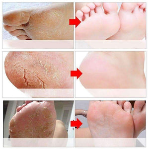 Planet Gates Feet Mask Peeling Socks for Pedicure Exfoliation for Feet Cream Patches Peeling Foot Mask Ant-aging Wrinkle Mask 3Pair