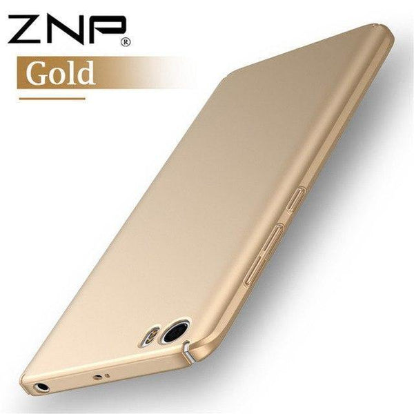 Planet Gates Gold / Mi 5 Fashion Hard Matte Case For Xiaomi Mi5 Cases Mi5s For Xiaomi Mi 5s Case 360 Full Protection FOR MI 5 Cover Plastic Phone Cases