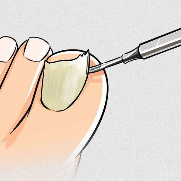 Planet Gates Nail tools stain steel ingrown nail tool Dead skin push