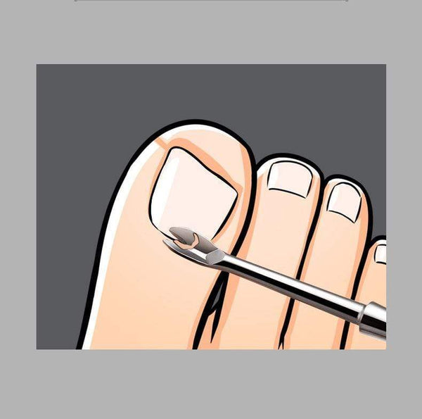 Planet Gates Nail tools stain steel ingrown nail tool Dead skin push