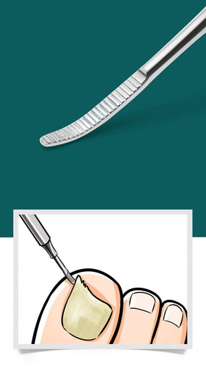 Planet Gates Nail tools stain steel ingrown nail tool Dead skin push