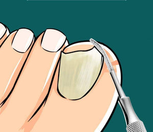Planet Gates Nail tools stain steel ingrown nail tool Dead skin push