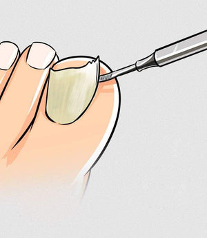 Planet Gates Nail tools stain steel ingrown nail tool Dead skin push