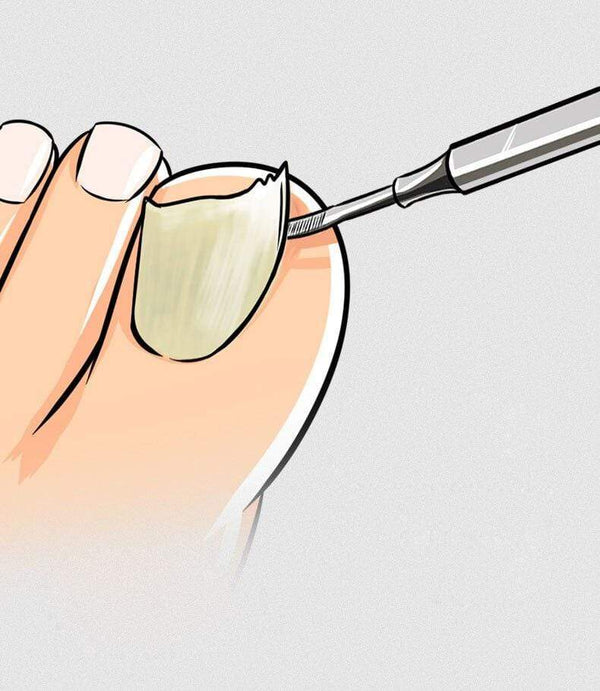 Planet Gates Nail tools stain steel ingrown nail tool Dead skin push